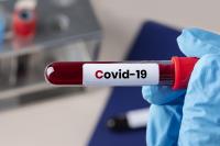 Covid-19: Mais 95 mortes e 9.927 novos casos nas últimas 24 horas