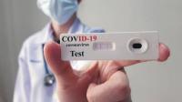 Covid-19: Farmácias venderam mais de um milhão de testes rápidos