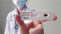 Covid-19: Farmácias fizeram quase 600 mil testes antes da passagem de ano - associação