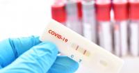 Covid-19: Farmácias garantem disponibilidade de testes apesar do aumento da procura