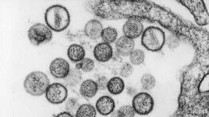 Cientistas alemães descobrem centenas de novos vírus que podem ser transmitidos aos humanos